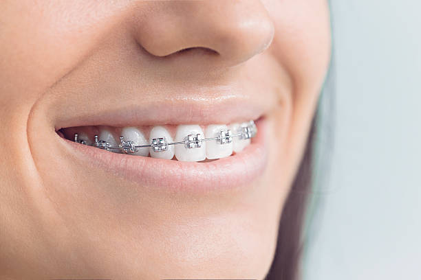 Why Choose Us for Your Dental Needs in University, FL